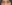 裏ハムラ法（経結膜的眼窩脂肪移動術） — ワンダフル美容外科クリニック