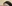 額（おでこ）のヒアルロン酸注入 — A-Top美容外科クリニック