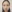 エラ削り（下顎角形成・エラ骨切り） — エックスオー美容外科クリニック