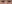 裏ハムラ法（経結膜的眼窩脂肪移動術） — ファクト美容外科クリニック