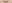裏ハムラ法（経結膜的眼窩脂肪移動術） — シンサエル美容外科