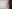 Nasal dorsum augmentation with implant (silicone/Gore-Tex) — Uri Plastic Surgery Clinic