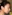 revision rhinoplasty — Litmus Plastic Surgery