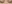 二重まぶた（自然癒着法） — ルホ美容外科クリニック