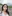 ผ่าตัดแก้จมูกบาน (ลดขนาดปลายจมูก) — คลินิกเสริมความงามชาร์ป (Sharp)