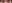 切開法（全切開法二重術） — プロミス美容外科クリニック
