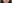 人中短縮（リップリフト） — プランナー美容外科クリニック