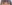裏ハムラ法（経結膜的眼窩脂肪移動術） — ハッシュ美容外科クリニック