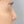 ผ่าตัดเอาสิ่งแปลกปลอมออกจากจมูก (เอาซิลิโคนจมูกออก) — ก่อนทำ (30วัน) · คลินิกศัลยกรรมพลาสติก ABEC