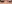 裏ハムラ法（経結膜的眼窩脂肪移動術） — イーエス清潭美容外科クリニック