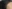 Hairline semi-permanent makeup (hairline micropigmentation / SMP) — TOP Plastic Surgery