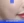 JUVÉDERM VOLITE / SKINVIVE (สกินบูสเตอร์ไฮยาลูรอน) — หลังทำ (17วัน) · คลินิกศัลยกรรมวี