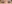 雙眼皮（自然沾黏法） — 普拉米斯整形外科