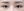 下眼睑下至术（开下眼角） — 术后 (7天) · POP医美诊所
