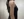 Back lipolysis injection (fat-dissolving injection) — after (7days) · Uline Clinic