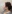 Double chin liposuction (submental liposuction) — Shinsang Plastic Surgery Clinic