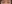 裏ハムラ法（経結膜的眼窩脂肪移動術） — プレジャー美容外科クリニック
