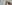 額（おでこ）の脂肪注入 — ファクト美容外科クリニック