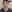 輪郭形成の修正手術（再手術） — ムイ美容外科クリニック