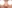 団子鼻修正（鼻尖縮小術） — ビギン美容外科クリニック