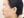 Ultherapy (Ulthera) micro-focused ultrasound lift — before · Monster Clinic