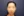 耳垂整形（丰耳垂/耳垂修复） — 术后 · Ideal整形外科
