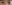revision eyelid surgery (secondary blepharoplasty) — iNique Plastic Surgery & Aesthetics