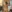 abdominal liposuction — Q-Line Women's Clinic