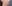 輪郭注射（小顔注射・脂肪溶解注射） — クレア美容外科クリニック