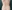 お腹の脂肪吸引（腹部脂肪吸引） — キュアライン女性クリニック