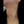 Neck wrinkle Botox (platysma band Botox / Nefertiti lift) — after (30days) · A-Top Plastic Surgery Clinic