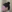 Double chin liposuction (submental liposuction) — Saegim Plastic Surgery Clinic