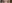 二重まぶた（自然癒着法） — プロミス美容外科クリニック