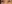 裏ハムラ法（経結膜的眼窩脂肪移動術） — プレジャー美容外科クリニック
