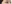 切開法（全切開法二重術） — IK美容外科クリニック