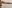 Arm liposuction — Balance Lab Plastic Surgery