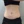 Back lipolysis injection (fat-dissolving injection) — after (14days) · Pladen Plastic Surgery Clinic