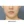 Volnewmer (โวลนิวเมอร์ ยกกระชับด้วย RF) — ก่อนทำ (30วัน) · คลินิกศัลยกรรมตกแต่งนาบี