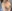 Breast augmentation with implants — Eight Plastic Surgery Clinic