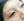 ลบรอยสักคิ้ว (ลบคิ้วกึ่งถาวร) — ก่อนทำ · คลินิก Rianchaewoom