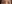 Lateral canthoplasty (outer corner opening) — Jewelry Plastic Surgery Clinic