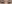 二重まぶた（自然癒着法） — メイドヨン美容外科クリニック