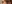 涙袋形成（脂肪注入） — ファクト美容外科クリニック