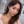 ผ่าตัดลดโหนกแก้มแบบเร็ว (ไม่ใส่ตัวยึด) — หลังทำ (90วัน) · ยูโนพลาสติกเซอร์เจอรี่