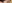 二重まぶた（自然癒着法） — ルホ美容外科クリニック