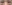 裏ハムラ法（経結膜的眼窩脂肪移動術） — スタート美容外科クリニック