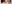 二重まぶた（自然癒着法） — イエロー美容外科クリニック