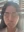 ฉีดไขมันตัวเองทั้งใบหน้า (ศัลยกรรมเติมไขมันใบหน้า) — ก่อนทำ (14วัน) · คลินิกศัลยกรรมตกแต่ง Jewelry