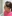 生え際の植毛（ヘアライン植毛） — バンスモザイナークリニック