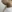 Double chin liposuction (submental liposuction) — Planner Plastic Surgery Clinic